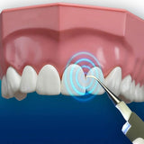 Limpiador Dental Sonic Pic con luz LED - additional image 14
